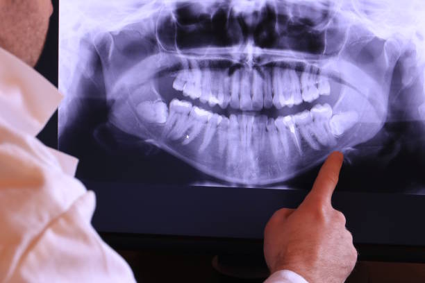 Urgent Tooth Repair in CO